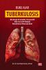 BUKU AJAR TUBERKULOSIS : Strategi Promotif, Preventif, dan Kuratif dalam Kesehatan Masyarakat