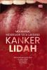 MEKANISME MOLEKULER TATA LAKSANA KANKER LIDAH